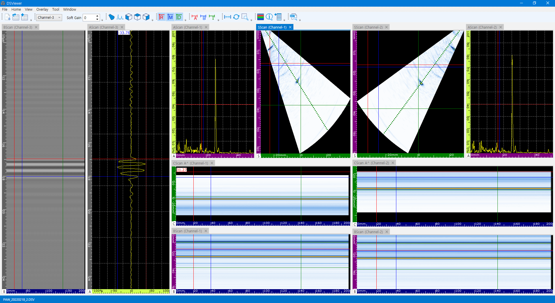 Multi-view channel group S-scan interface